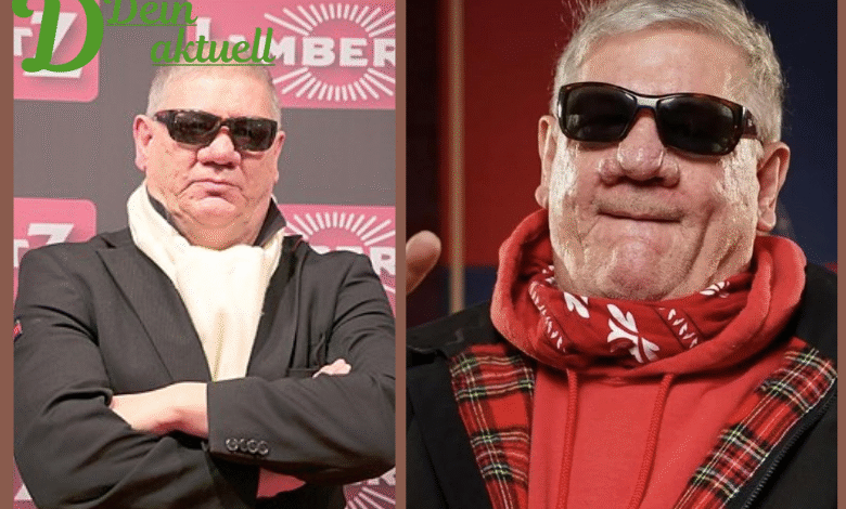 Claude-Oliver Rudolph Nase Krankheit: Ursachen, Spekulationen & Gesundheit